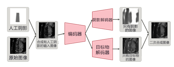 理研开发出通过B超判读胎儿心脏病的AI技术