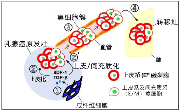 日本发现促进乳腺癌浸润和转移的新机制,有望开发新疗法