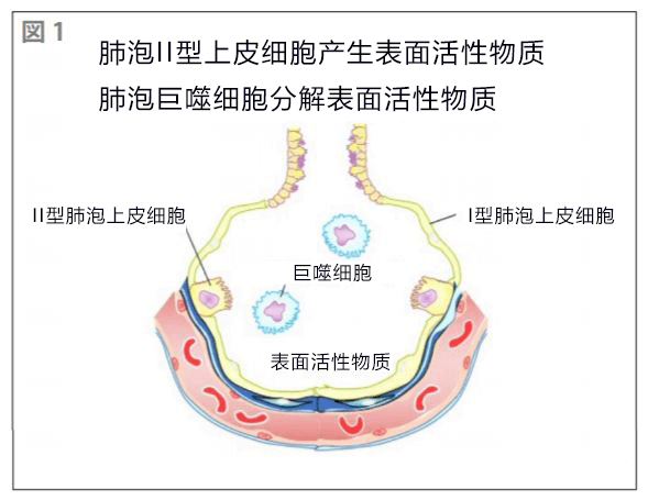 千叶大学等验证吸入疗法对难治性呼吸系统疾病的效果,可治疗自身免疫性肺泡蛋白沉积症