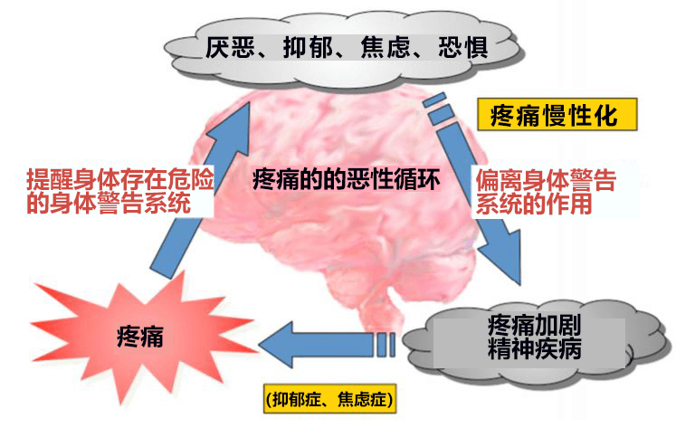 日本北海道大学查清慢性疼痛让人心情沮丧的机理