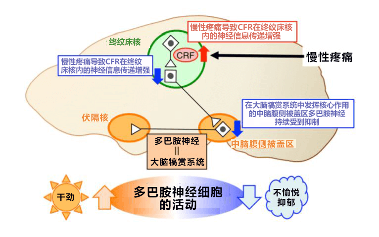 日本北海道大学查清慢性疼痛让人心情沮丧的机理