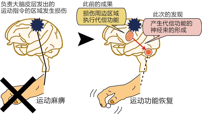脑损伤后可形成新的神经束,适当促进大脑变化可恢复运动功能