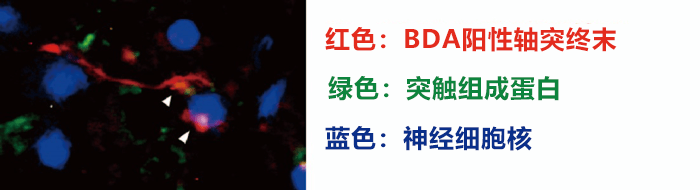 脑损伤后可形成新的神经束,适当促进大脑变化可恢复运动功能