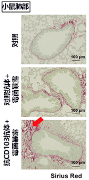 治疗霉菌性肺纤维化的关键！日本明确导致肺部组织纤维化的新细胞群