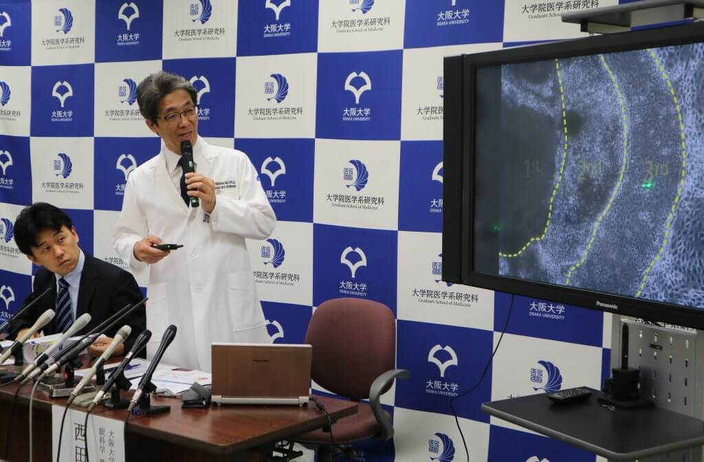 大阪大学实现iPS细胞制备视网膜的自动化量产,成本降九成