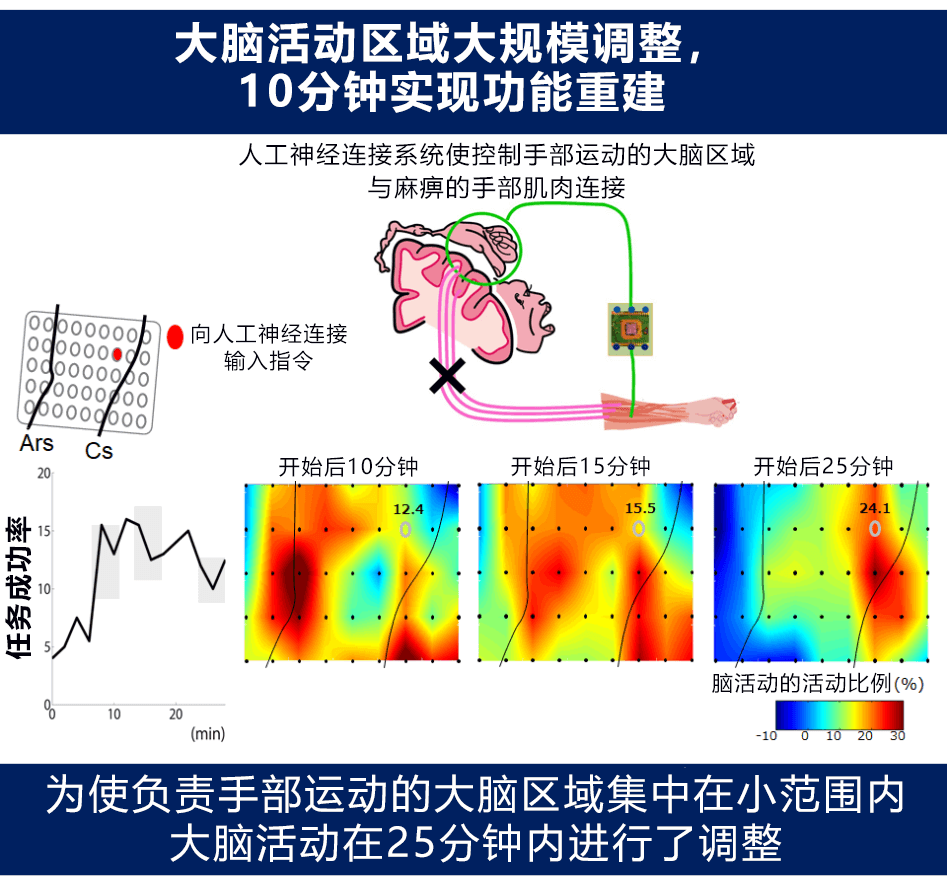 人工神经连接系统让脑梗塞患者重拾手部运动功能