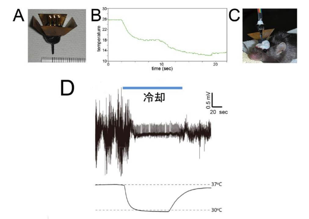 冷却大脑治癫痫——日本查清癫痫病情恶化的分子机制