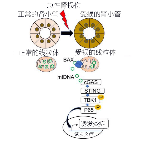 日本发现急性肾损伤(AKI)伴生炎症新机制