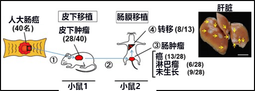 日本查明大肠癌的新转移机制，将开发以癌细胞群为靶点的大肠癌转移抑制疗法