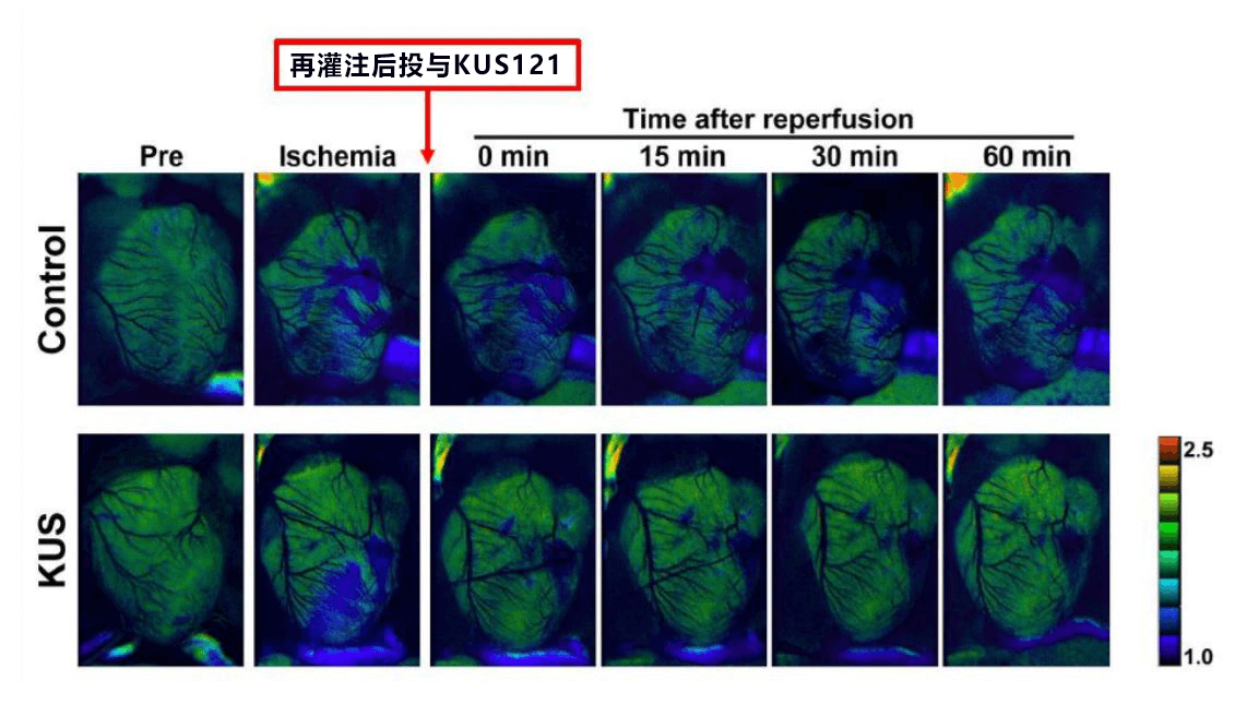 京都大学候选新药可缩小心梗面积，有望成为抑制再灌注损伤的新疗法