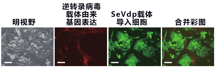 筑波大学利用iPS细胞发现逆转录病毒基因沉默新机制