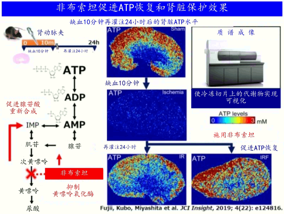 日本查清降尿酸药物控制代谢来抑制肾衰竭的机制