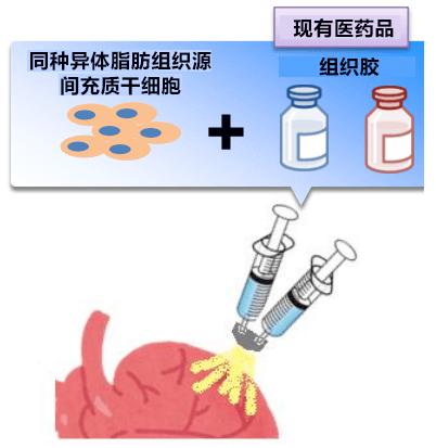 细胞喷雾法治疗心衰，阪大医院开始临床试验