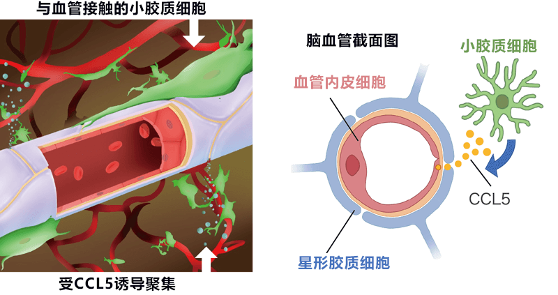 精神分裂症及神经退行性疾病治疗的好消息！日本查明脑内小胶质细胞可控制血脑屏障