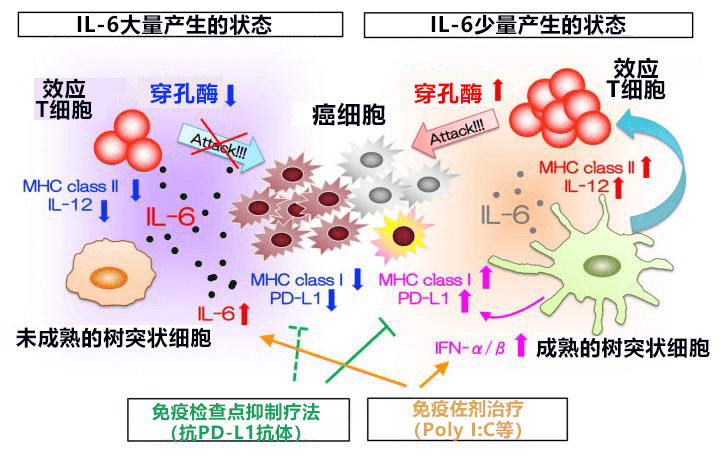 日本查清促进大肠癌肝转移的新控制机制，阻断IL-6信号有望抑制转移