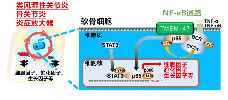 全球首次！日本发现软骨细胞会诱发关节炎