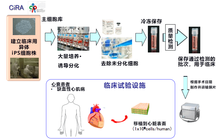 大阪大学成功移植iPS细胞心肌片至患者心脏