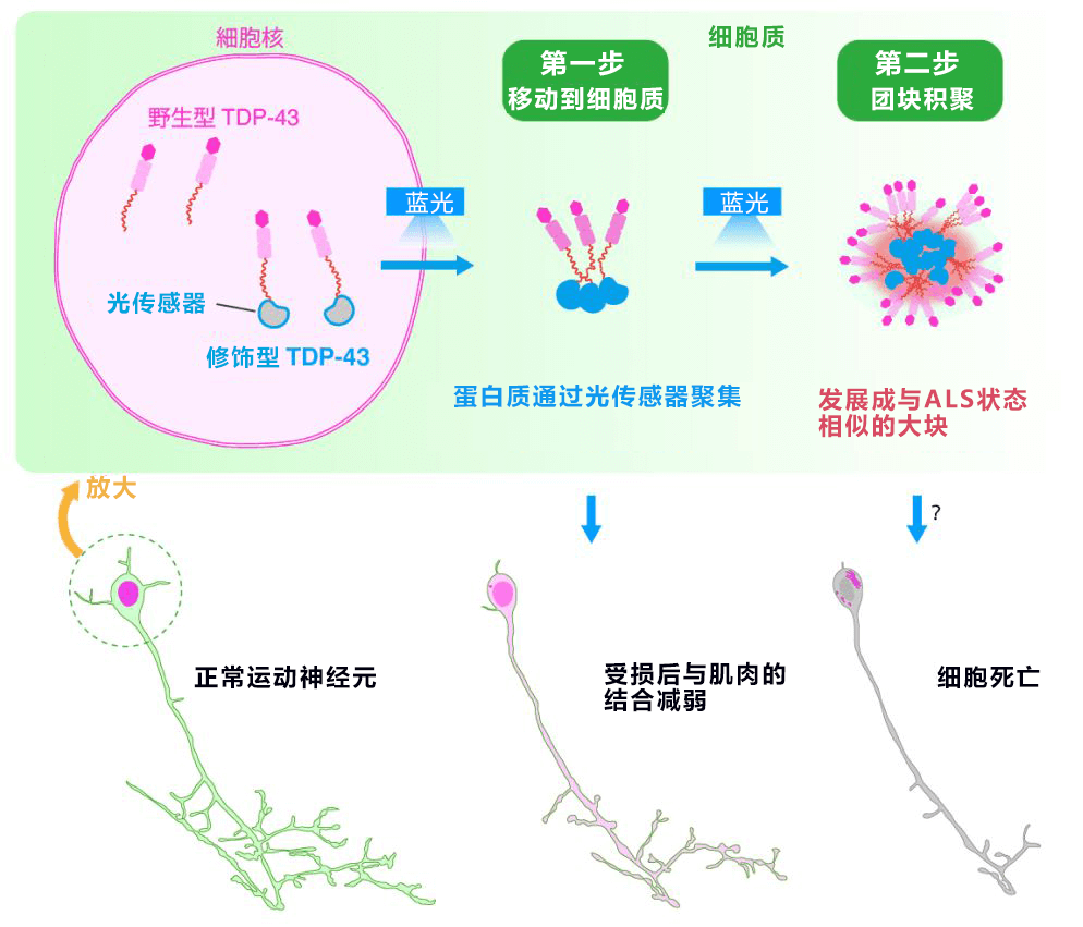 用光照射再现渐冻症,有望查清发病机制并开发新药