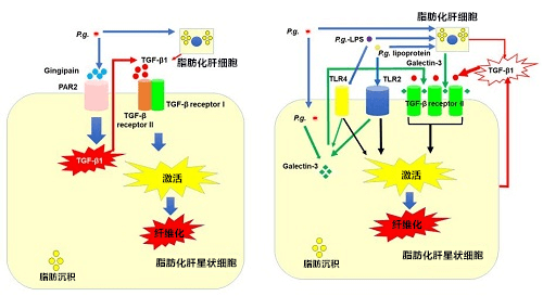 广岛大学：牙周炎可加剧非酒精性脂肪性肝病